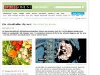 Bild zum Artikel: Ein rätselhafter Patient: Das Kind im Kinde