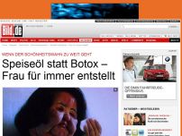 Bild zum Artikel: Schönheitswahn - Speiseöl statt Botox – Frau für immer entstellt