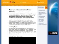 Bild zum Artikel: Mann fuhr mit abgetrenntem Arm in Ambulanz