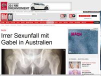 Bild zum Artikel: Grusel-Röntgenbild - Australier führt sich Gabel in Penis ein
