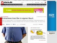 Bild zum Artikel: Kurioser Krankheitsfall: US-Amerikaner braut Bier im eigenen Bauch