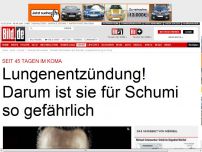 Bild zum Artikel: Neue Sorge - Michael Schumacher: Lungenentzündung im Koma!