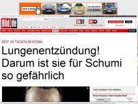 Bild zum Artikel: Neue Sorge - Michael Schumacher: Lungenentzündung im Koma!