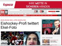 Bild zum Artikel: Zehn Zähne weg - Eishockey-Profi twittert Ekel-Foto