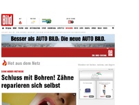 Bild zum Artikel: Dank neuer Methode - Schluss mit Bohren beim Zahnarzt