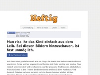 Bild zum Artikel: Man riss ihr das Kind einfach aus dem Leib. Bei diesen Bilder hinzuschauen, ist fast unmöglich.