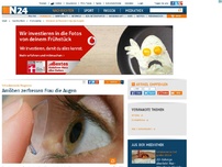 Bild zum Artikel: Schockierender Fall - 
Amöben zerfressen Frau die Augen