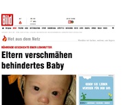 Bild zum Artikel: Leihmutter-Schicksal - Eltern verschmähen behindertes Baby