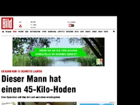 Bild zum Artikel: Seltene Krankheit - Der Mann mit dem 45-Kilo-Hoden