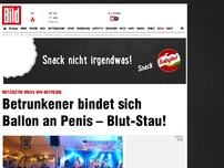 Bild zum Artikel: Bizarrer Unfall - Mann bindet sich Luftballon um Penis