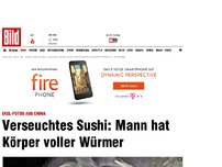 Bild zum Artikel: Mann in China hat Körper voller Maden