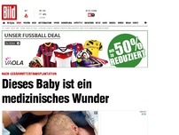 Bild zum Artikel: Dieses Baby ist ein medizinisches Wunder