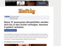 Bild zum Artikel: Diese 27 grausamen Körperbilder werden dich bis in den Schlaf verfolgen. Nummer 9 gehört verboten.