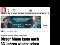 Bild zum Artikel: Medizinische Sensation - Mann kann nach 33 Jahren wieder sehen