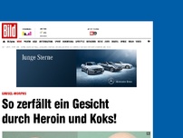 Bild zum Artikel: Grusel-Morphs - So zerfällt ein Gesicht durch Heroin und Koks!