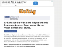 Bild zum Artikel: Er kam auf die Welt ohne Augen und mit krummen Armen. Dann versuchte der Vater einfach mal etwas.