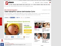 Bild zum Artikel: Mutter verstößt Baby mit Down-Syndrom: Vater kämpft für seinen behinderten Sohn