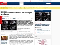 Bild zum Artikel: Ärzte staunen - Neugeborenes Mädchen ist mit Zwillingen schwanger