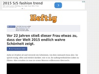 Bild zum Artikel: Vor 22 Jahren stieß dieser Frau etwas zu, dass der Welt 2015 endlich wahre Schönheit zeigt.