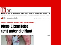 Bild zum Artikel: Beinharter Liebesbeweis - Eltern tätowieren sich Muttermal ihrer Tochter