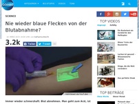 Bild zum Artikel: Nie wieder blaue Flecken von der Blutabnahme?