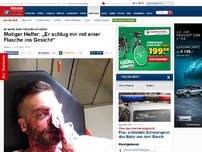 Bild zum Artikel: Er wollte eine Freundin schützen - Mutiger Helfer: „Er schlug mir mit einer Flasche ins Gesicht“