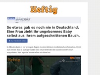 Bild zum Artikel: So etwas gab es noch nie in Deutschland. Eine Frau zieht ihr ungeborenes Baby selbst aus ihrem...
