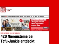 Bild zum Artikel: Not-Operation - 420 Nierensteine bei Tofu-Junkie entdeckt