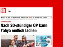 Bild zum Artikel: Junge ohne Gesicht - Nach OP kann Yahya endlich lachen 