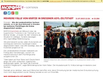 Bild zum Artikel: Mehrere Fälle von Krätze in Dresdner Asyl-Zeltstadt
