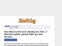 Bild zum Artikel: Das Baby kratzt sich ständig am Hals. 3 Wochen später wächst DAS aus ihm heraus!