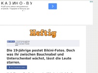 Bild zum Artikel: Die 19-Jährige postet Bikini-Fotos. Doch was ihr zwischen Bauchnabel und Unterschenkel wächst,...