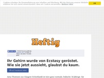 Bild zum Artikel: Ihr Gehirn wurde von Ecstasy geröstet. Wie sie jetzt aussieht, glaubst du kaum.