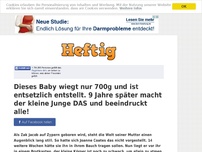 Bild zum Artikel: Dieses Baby wiegt nur 700g und ist entsetzlich entstellt. 9 Jahre später macht der kleine Junge...