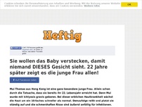 Bild zum Artikel: Sie wollen das Baby verstecken, damit niemand DIESES Gesicht sieht. 22 Jahre später zeigt es die...