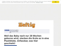 Bild zum Artikel: Weil das Baby nach nur 28 Wochen geboren wird, stecken die Ärzte es in eine Plastiktüte....