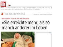 Bild zum Artikel: „Hope“ lebte nur 74 Minuten - »Sie erreichte mehr, als so manch anderer im Leben