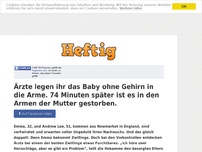 Bild zum Artikel: Ärzte legen ihr das Baby ohne Gehirn in die Arme. 74 Minuten später ist es in den Armen der...