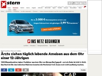 Bild zum Artikel: Ekel-Insekten-Alarm in Indien: Ärzte ziehen lebende Ameisen aus dem Ohr eines 12-jährigen Mädchens - und das jeden Tag