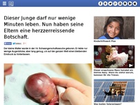 Bild zum Artikel: Dieser Junge darf nur wenige Minuten leben. Nun haben seine Eltern eine herzzerreissende Botschaft.