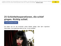 Bild zum Artikel: 25 Schönheitsoperationen, die schief gingen. Richtig schief.