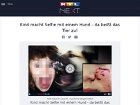 Bild zum Artikel: Kind macht Selfie mit einem Hund - da beißt das Tier zu!