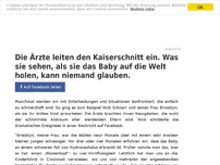 Bild zum Artikel: Die Ärzte leiten den Kaiserschnitt ein. Was sie sehen, als sie das Baby auf die Welt holen, kann niemand glauben.