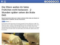 Bild zum Artikel: Die Eltern wollen ihr totes Frühchen nicht loslassen - 2 Stunden später sehen die Ärzte DAS