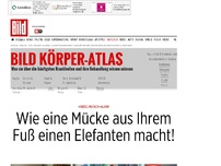 Bild zum Artikel: Kriebelmücken-Alarm - Wie eine Mücke aus Ihrem Fuß einen Elefanten macht!  