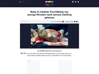 Bild zum Artikel: Baby in intakter Fruchtblase nur wenige Minuten nach seinem Zwilling geboren