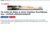 Bild zum Artikel: So sieht ein Baby in einer intakten Fruchtblase aus – einfach atemberaubend!