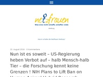 Bild zum Artikel: Nun ist es soweit – US-Regierung heben Verbot auf – halb Mensch-halb Tier – die Forschung kennt keine Grenzen ! NIH Plans to Lift Ban on Human-Animal Hybrid Research