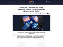 Bild zum Artikel: Eltern von Zwillingen mit Down-Syndrom: 'Dieses Extra-Chromosom ist keine große Sache'