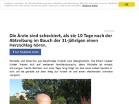 Bild zum Artikel: Die Ärzte sind schockiert, als sie 10 Tage nach der Abtreibung im Bauch der 31-Jährigen einen Herzschlag hören.